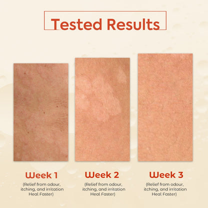 Permisense_medicated_Soap_PACK_3_Mockup-min